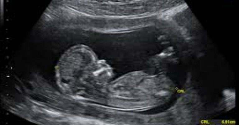 Good News for the Cause of Life: Abortion Rate Decreasing in U.S.