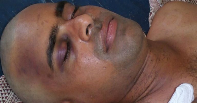 Hindu Extremists Beat Pastor Unconscious in Southern India after ‘Miraculous’ Conversions