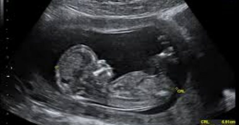 Ultrasound Ad Is Too ‘Political,’ Government Company Says