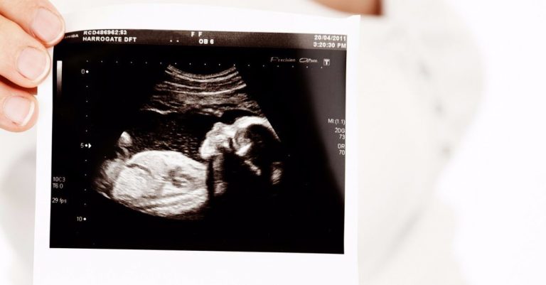 Georgia’s Abortion Rate Has Declined More than 18 Percent over the Last 23 Years