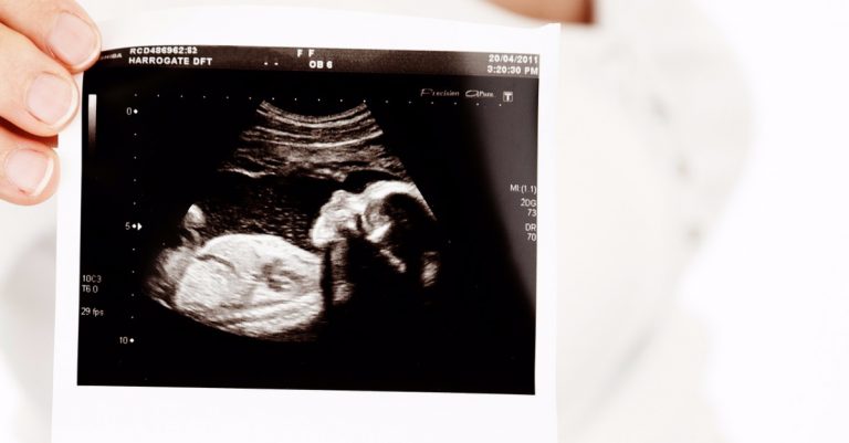 Mississippi House Passes Bill that Would Ban Abortions Based on Race, Sex, Genetic Abnormalities