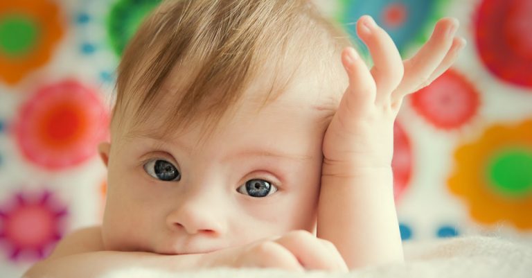 ‘Lives Worth Protecting’ – Trump Admin. Backs Ohio Down Syndrome Abortion Ban