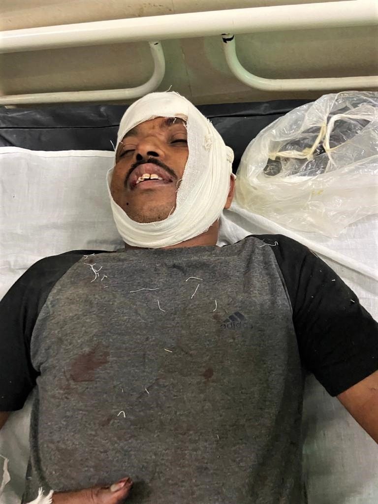 Christian Leader Suffers Multiple Fractures After Being Brutally Beaten, Run Over With Motorcycles by Hindu Extremists Who Mocked His Faith
